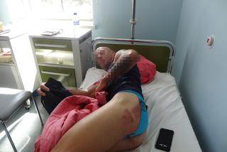 Mordercza opona chciała mnie zabić