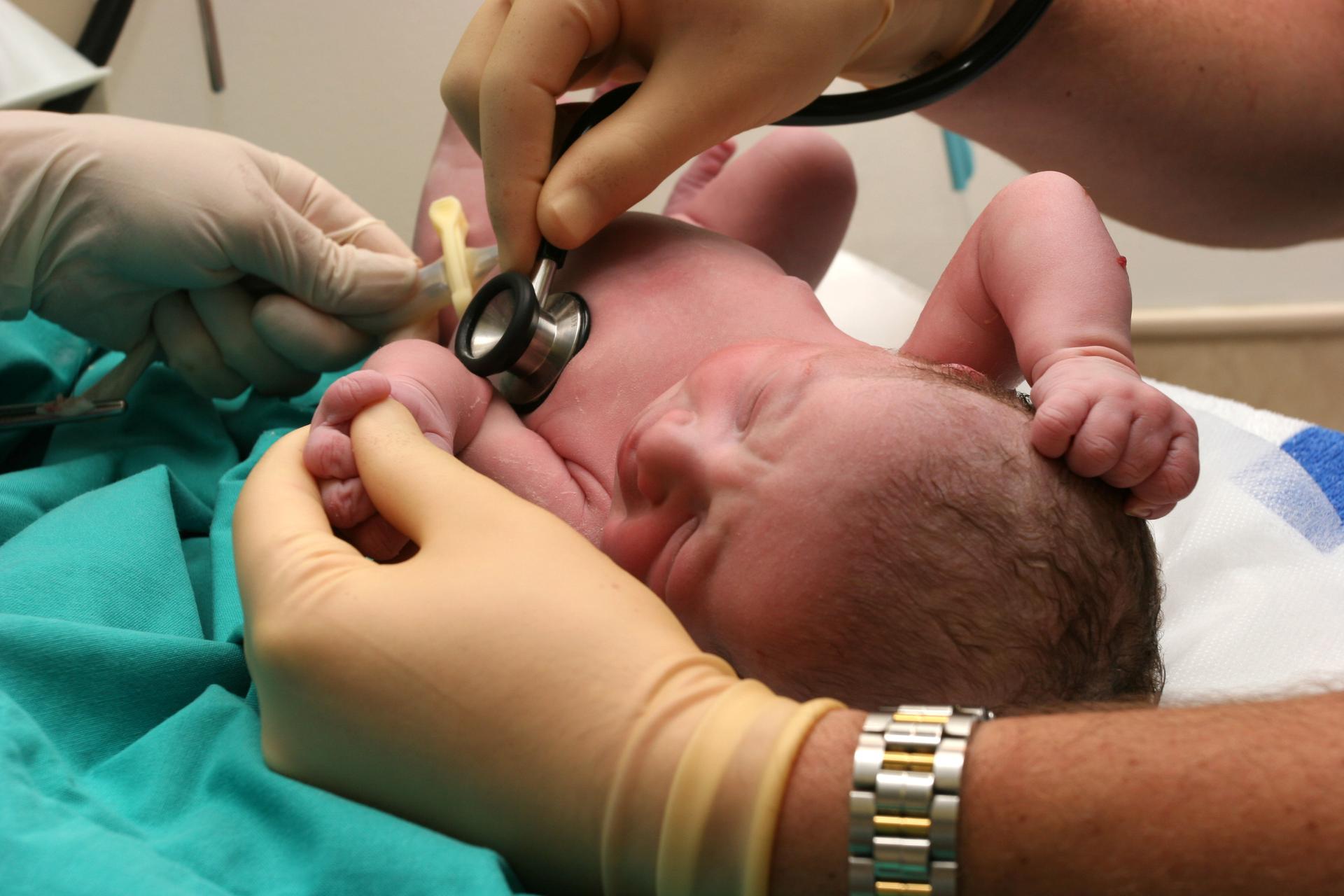 Гипоксия мозга у ребенка. Асфиксия новорожденных. Асфикия у новорождённого. Асасфиксия у новорожденного.