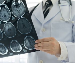 Lobotomia (leukotomia) - co to za zabieg? Wskazania do lobotomii