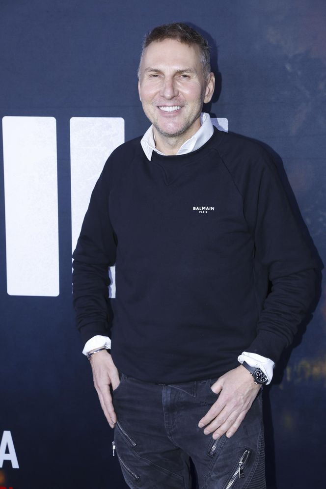 Krzysztof Gojdź zafundował sobie lifting twarzy. "Zabieg jest bezbolesny"