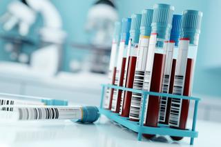 Morfologia krwi - badanie krwi pokaże całą prawdę o stanie twojego zdrowia 