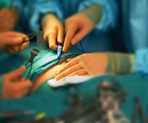 Chirurgiczne leczenie otyłości: rodzaje operacji bariatrycznych