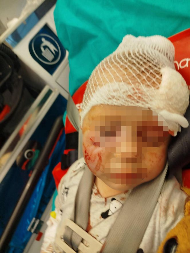 Pies pogryzł 3-latka na przystanku