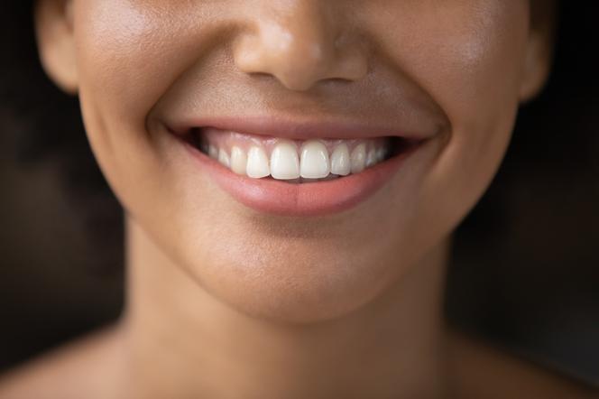 Wybielasz zęby tą metodą? Eksperci mają złą wiadomość 