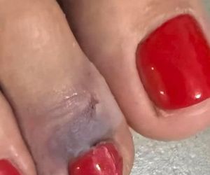 Dowbor nosi Koroniewską na rękach. Gwiazda zrobiła sobie kuku!