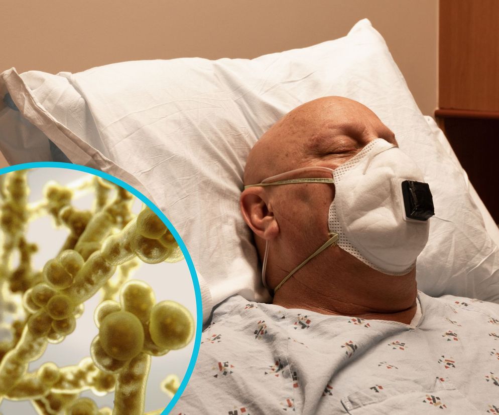 Śmiercionośny grzyb Candida Auris szczerzy się w szpitalach. Nie reaguje na leki