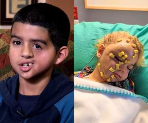 Ta choroba sprawia, że znika pół twarzy. #MEDetektyw: zespół Parry’ego-Romberga