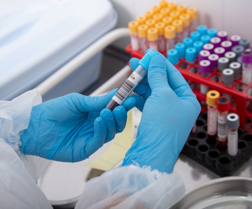 Laboratorant trzyma próbkę krwi