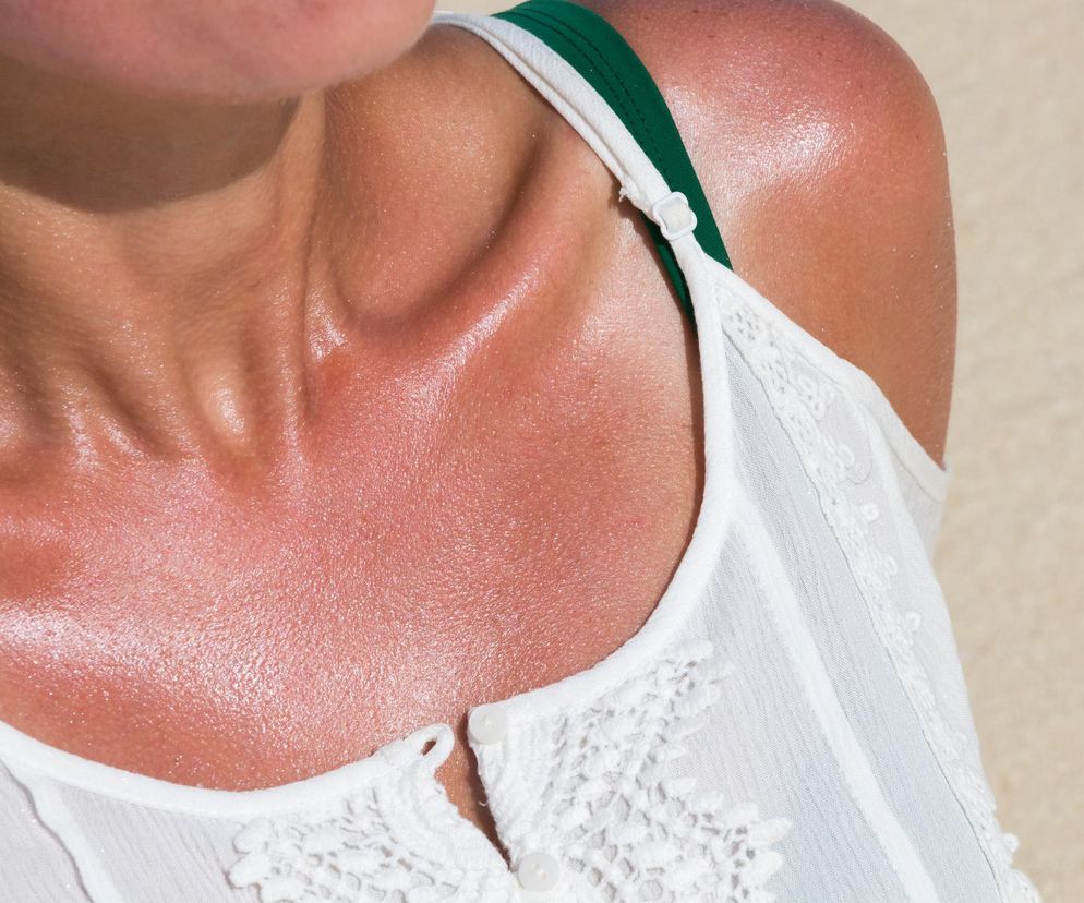 Najlepszy sposób na oparzenia słoneczne. Babcia zrywała pędy i smarowała nam ramiona