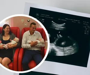 W Bydgoszczy urodziły się trojaczki. Gabrysia, Martynka i Julka ważyły 1,5 kg