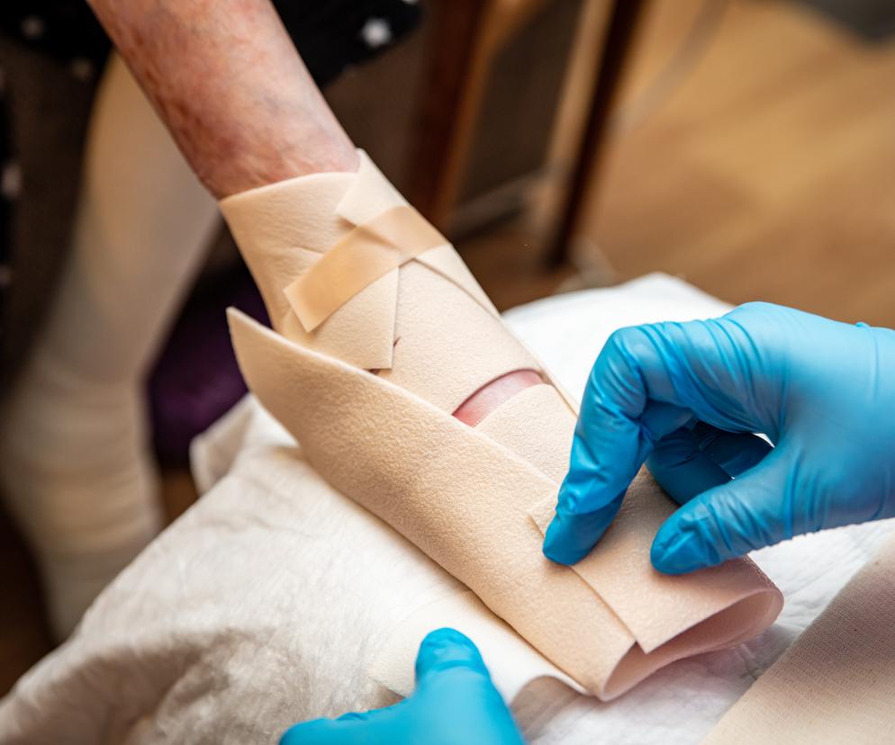 Epidermolysis Bullosa - pęcherzowe oddzielanie się naskórka
