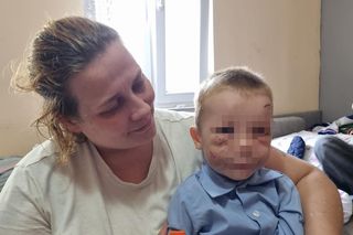 Pies pogryzł 3-latka na przystanku