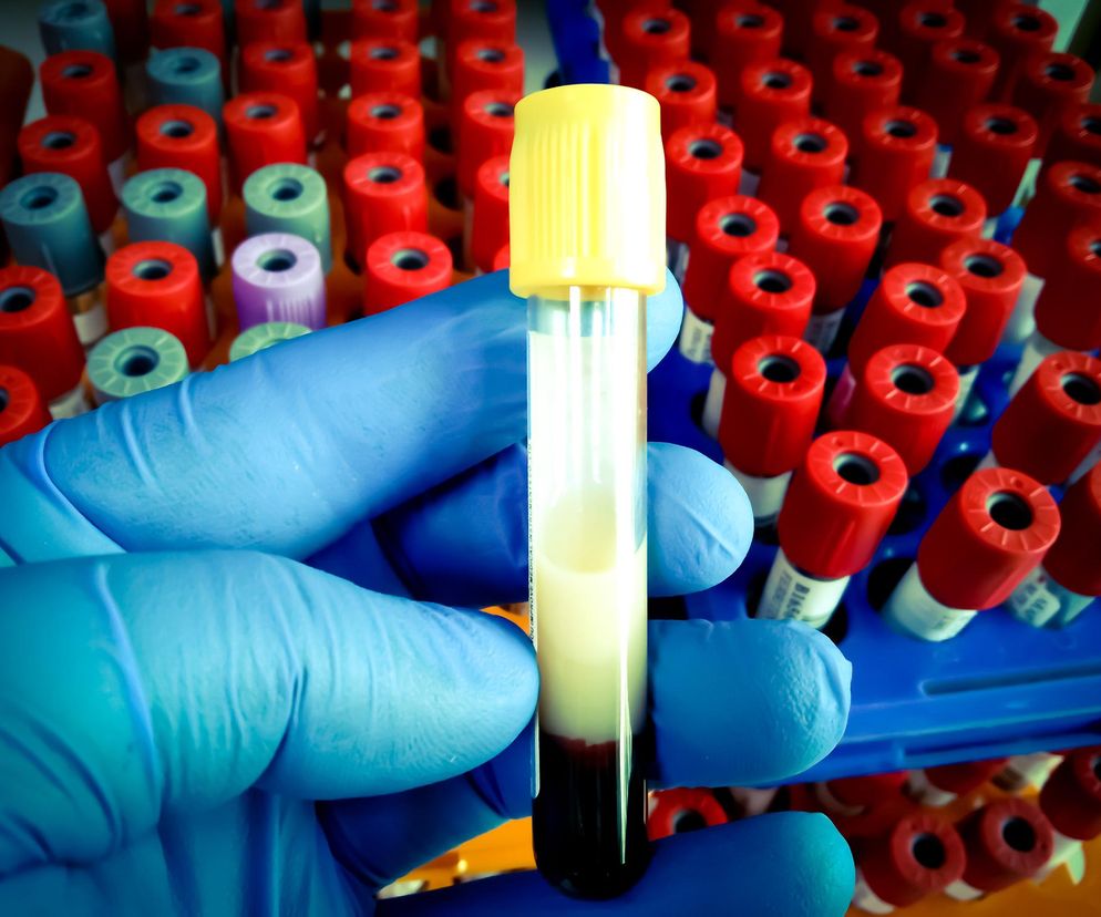 Pierwsza szczepionka na zły cholesterol. Zmniejsza LDL aż o 30 proc. 