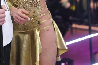 Posiniaczone nogi i porwane sukienki w TzG. Oto najgorsze wpadki