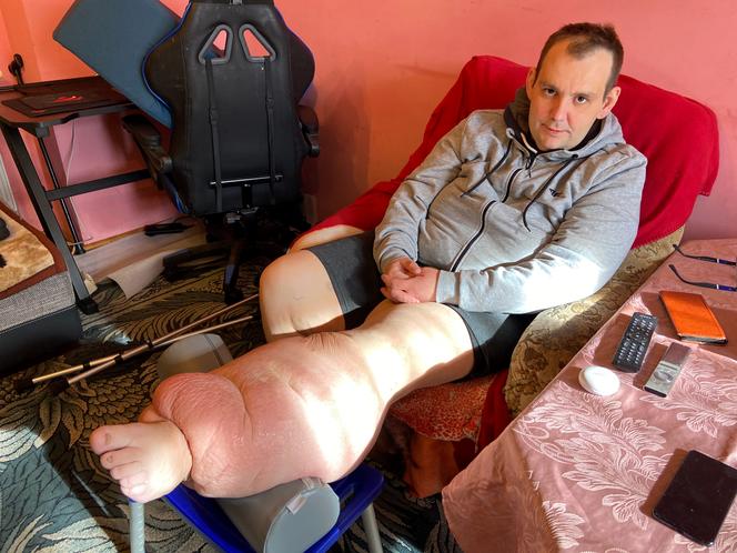 Paweł Kitlas (39 l.) z Białegostoku cierpi na tajemniczą chorobę. Lekarze w Polsce nie potrafią mu pomóc