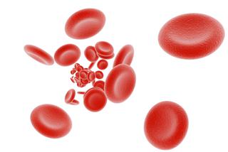Napadowa nocna hemoglobinuria - przyczyny, objawy, skutki i powikłania