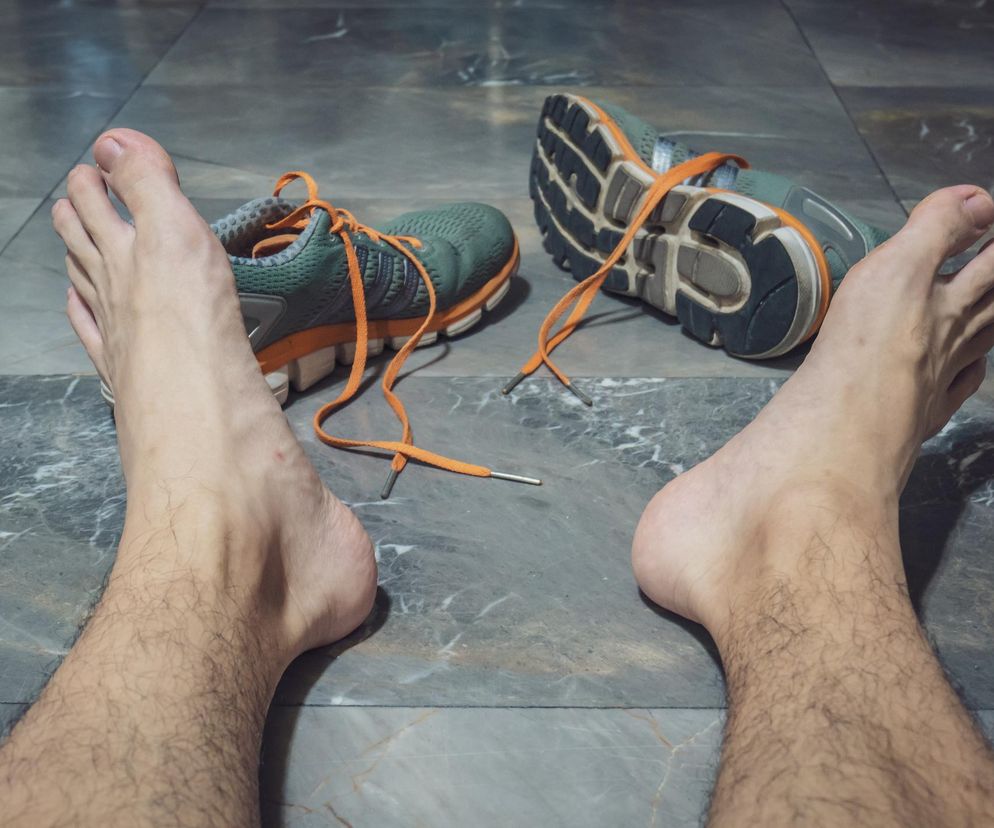 Gdy zmiana butów i mycie nie pomaga. Spocone stopy objawem choroby?