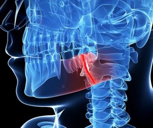 Złamanie szczęki - objawy, leczenie, zapobieganie