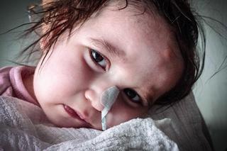 Życie Karolinki z Lublina wisi na włosku. Zostało bardzo mało czasu! Ratunkiem operacja w USA