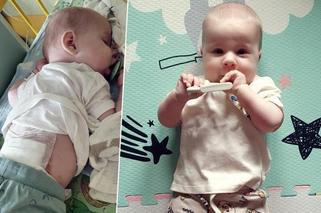 Malutki Oliwierek z Wadowic cierpi na straszną chorobę. Płakaliśmy nad kartką, na której widniał wyrok śmierci