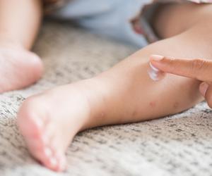 Lekarze upierali się, że to ospa. 16-miesięczny chłopiec zmarł po błędnej diagnozie 