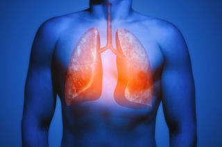 Co koronawirus robi z płucami człowieka? Wstrząsające nagranie