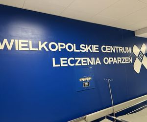 Niespełna dwuletni chłopiec ciężko poparzony. Jest w szpitalu w Ostrowie