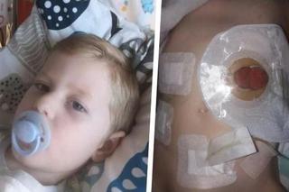 Mały Antoś chce mieć normalne dzieciństwo