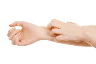 Kontaktowe zapalenie skóry - przyczyny. Co wywołuje wyprysk kontaktowy?