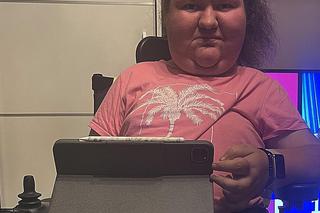 Olę wyniszcza potworna choroba. 23-latka szuka pracy, by zarobić na leczenie