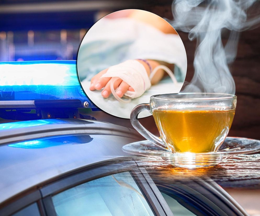 Poparzony 2-latek walczy o życie w szpitalu. Nowe ustalenia policji