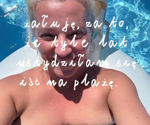 Dorota Szelągowska nie wstydzi się rozstępów