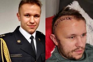 31-letni strażak walczy o życie. „Pojawił się on, glejak mózgu”