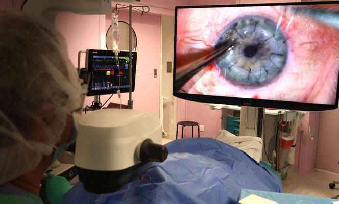 Szpital w Sosnowcu bije rekordy. To absolutny lider w przeszczepach rogówki w Polsce