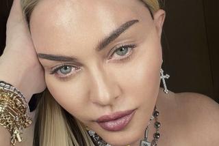  Madonna ma nową twarz! 64-latka przeszła kolejne operacje?