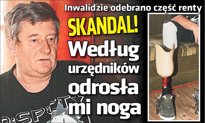 Chory na cukrzycę Kazimierz Drabik (61 l.) może wkrótce stracić drugą nogę, ale dla  urzędników jest  umiarkowanie niepełnosprawny