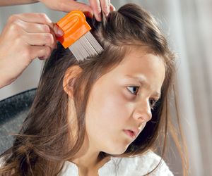 Gnidy to jaja wszy. Jak się ich pozbyć?