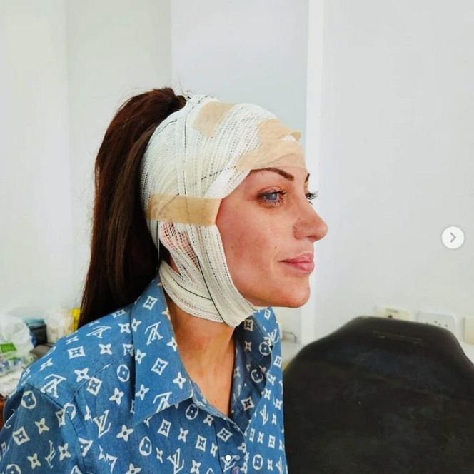 Nie żyje "Ludzka Barbie"! 31-letnia influencerka znaleziona martwa w mieszkaniu!