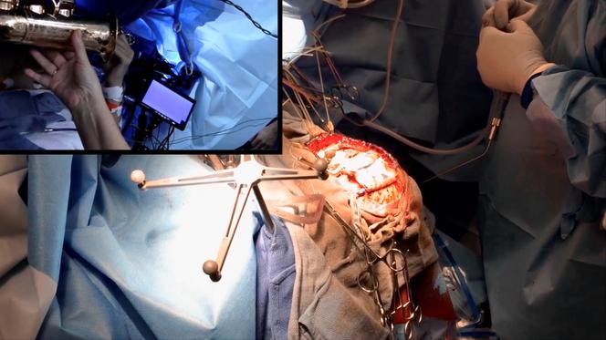 Grał na saksofonie, gdy operowali mu mózg