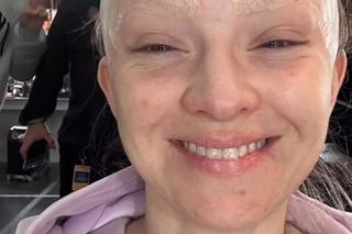 Basia Kurdej-Szatan oszpecona