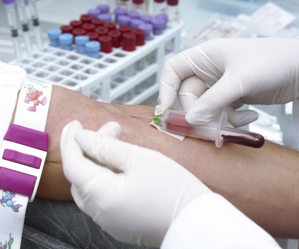 Czy do morfologii czyli podstawowego badania krwi, nie trzeba się specjalnie przygotowywać?