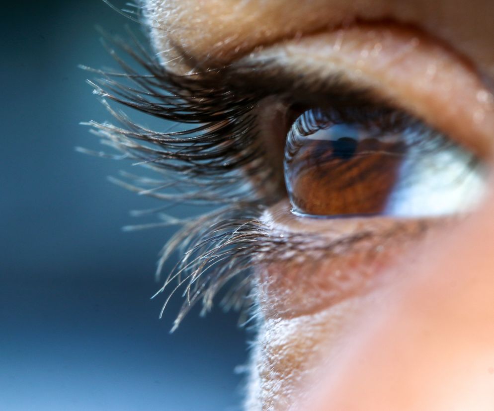 Od anemii do udaru: objawy tych chorób łatwo dostrzeżesz w oczach