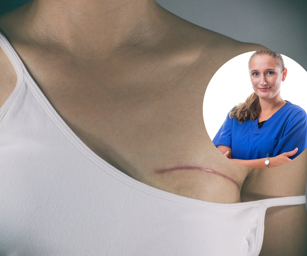 Trafiają do niej pacjentki z blizną zrośniętą z jelitem czy żebrami