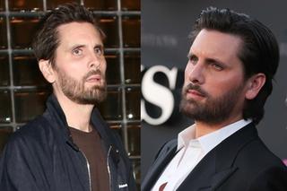 Ozempic face Przerażające efekty magicznej diety! Ekspertka bije na alarm