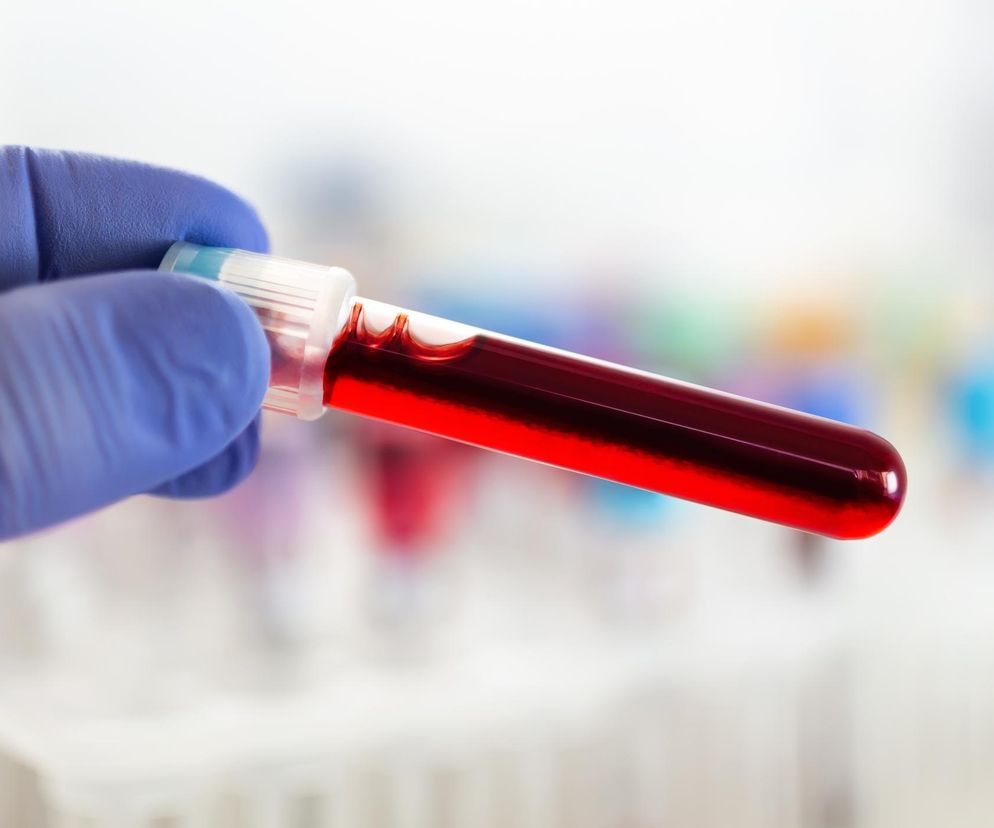 Cholesterol zdetronizowany po 60 latach? Prosty test ma lepiej ocenić ryzyko chorób serca