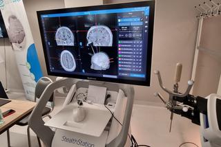 Lekarze ze Szczecina zrobili to jako pierwsi. 16-letniemu Igorowi wszczepiono nowoczesne elektrody