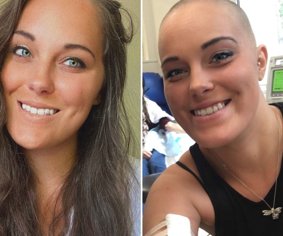 Usłyszała, że jest za młoda na raka. Lekarze zignorowali jej objawy, twierdząc, że to hormony