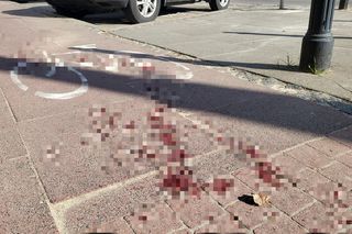 Atak nożownika pod kebabem w Warszawie