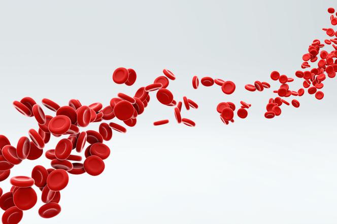 hemofilia zdjęcie
