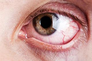 Choroby, które kradną wzrok